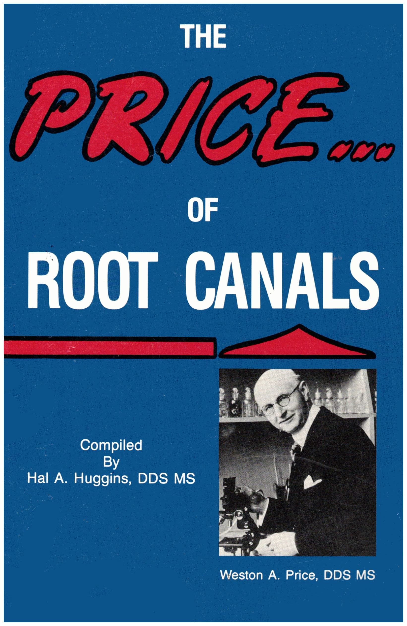 The Price of Root Canals